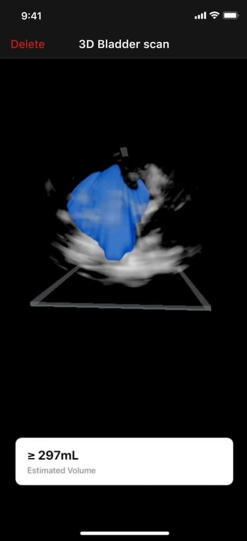 Portable ultrasound for Urology Butterfly iQ3